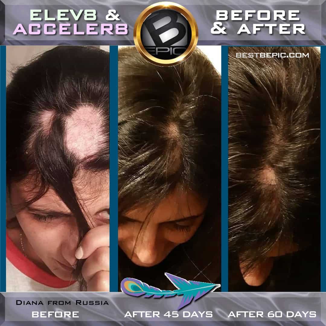 Elev8-Acceler8 for hair