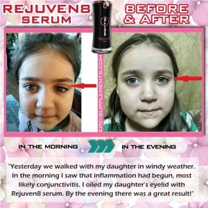 Rejuven8 Child's Effect: before and after