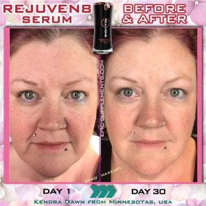 b-epic rejuven8 serum before&after
