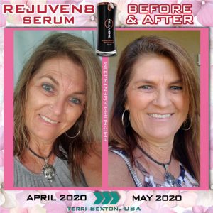 b-epic rejuven8 serum before&after (USA)