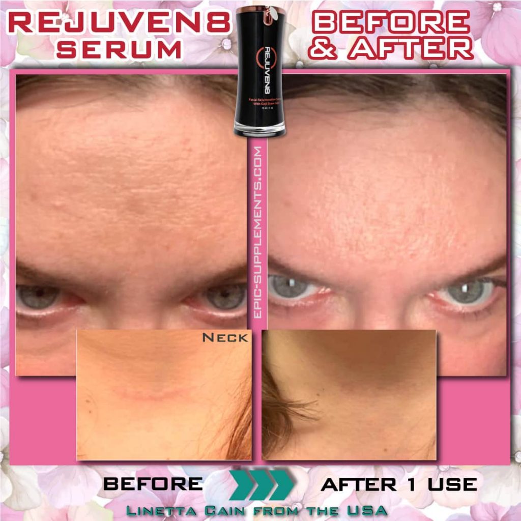 bepic Rejuven8 serum review