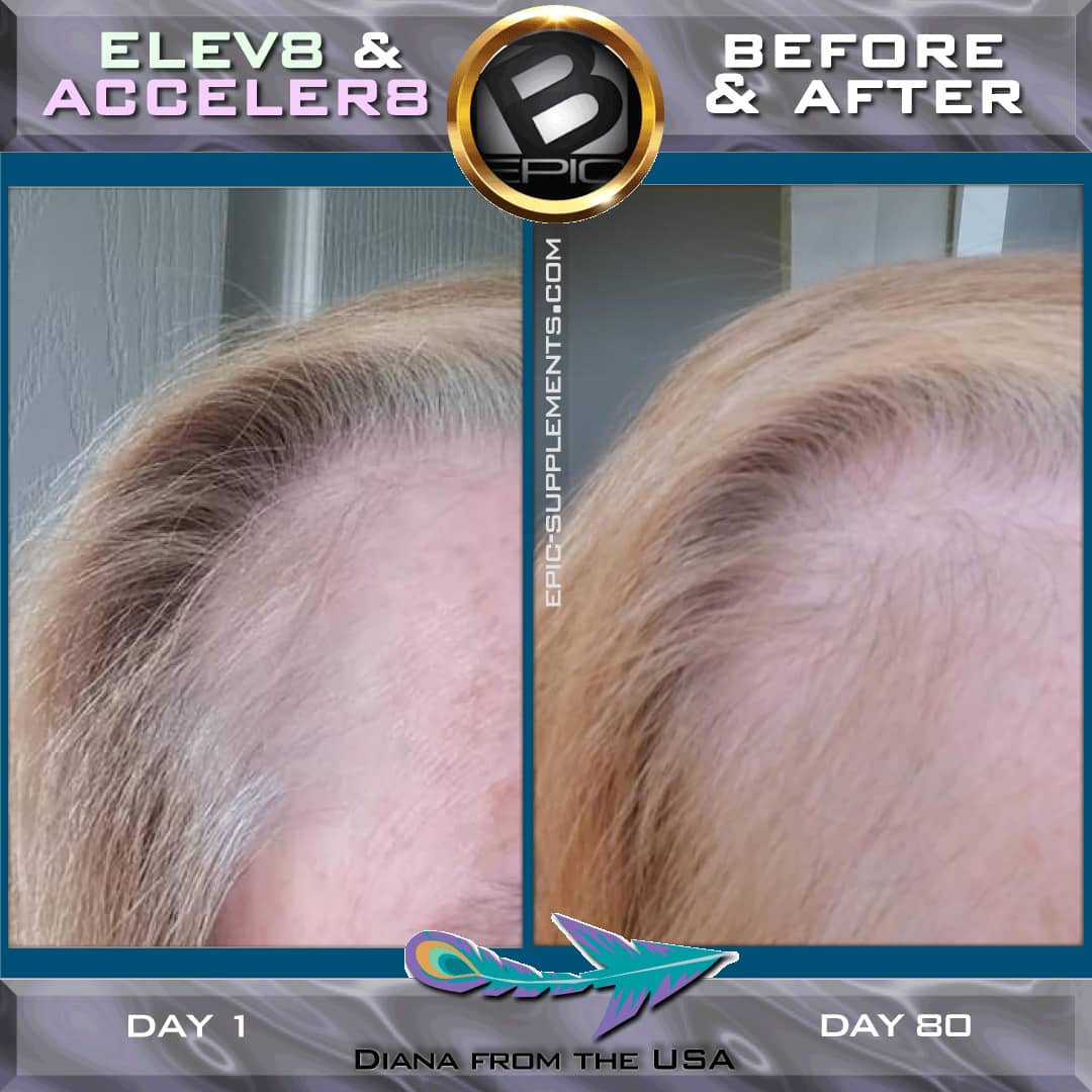 bepic pills for hair (result)