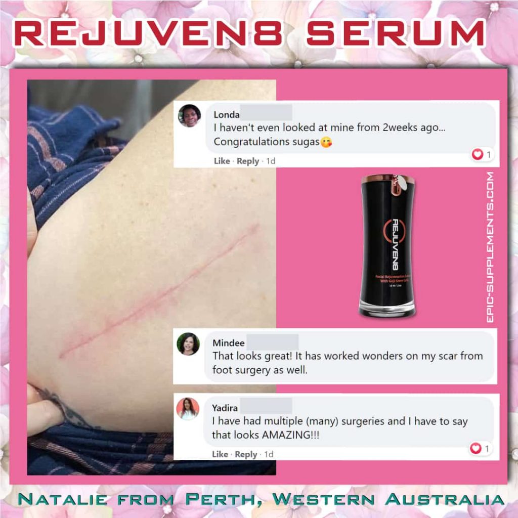 bepic's rejuven8 serum against surgery scars (real picture)