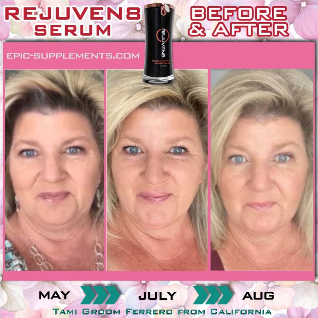 Bepic Rejuven8 skin serum (testimonial from california, USA)