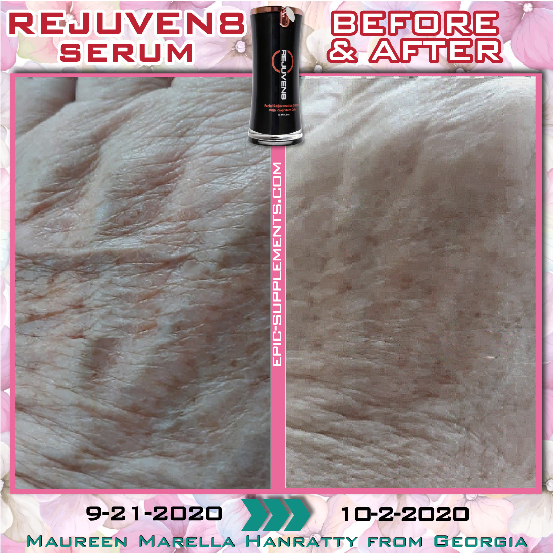 Bepic's Rejuven8 serum for hand skin