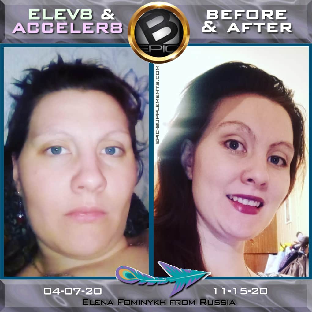 visual transformation with B-Epic 3-pill-system (before and after)