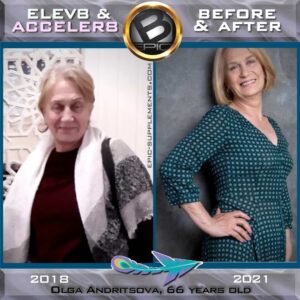 Before and after Bepic weight loss supplements